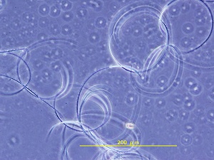 2007-isou_sperm.jpg